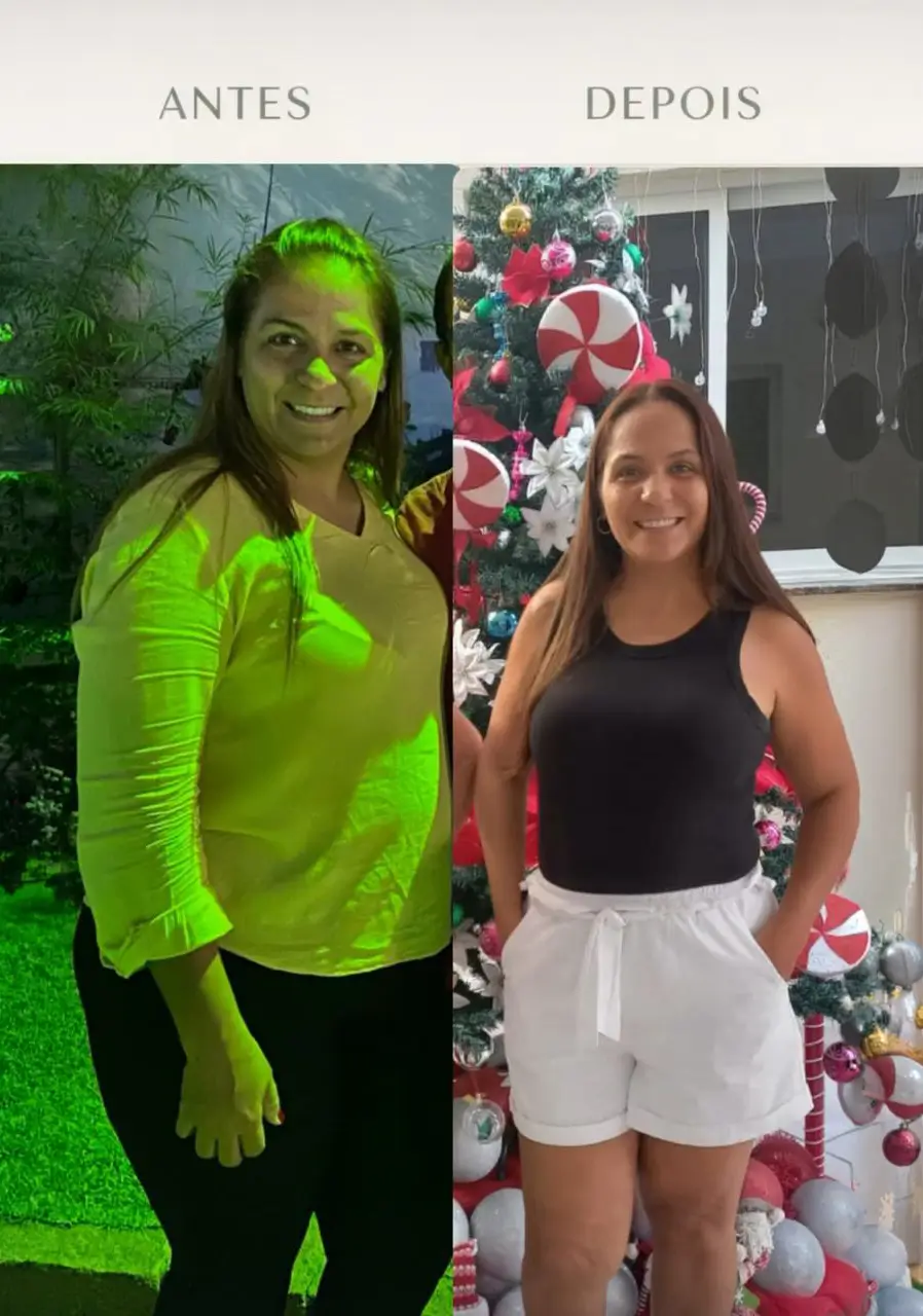 Antes e Depois Luciene